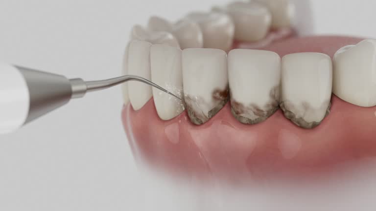 Reliable Dental contractor in St. James, MN by Smile Center Dentistry